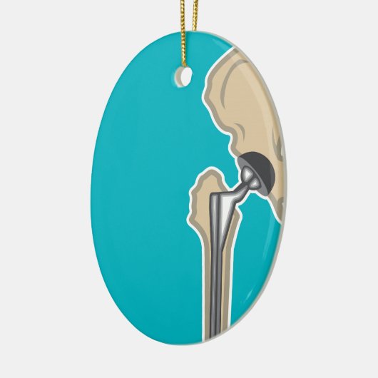 Heupgewrichtsvervanging Keramisch Ornament (Links)
