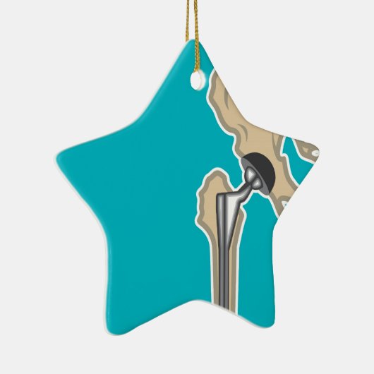 Heupgewrichtsvervanging Keramisch Ornament (Rechts)