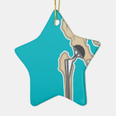 Heupgewrichtsvervanging Keramisch Ornament (Links)