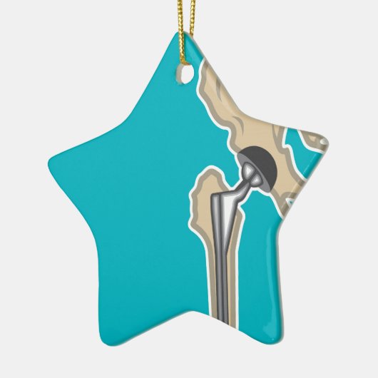 Heupgewrichtsvervanging Keramisch Ornament (Links)