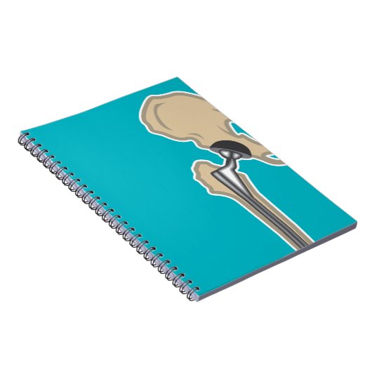 Heupgewrichtsvervanging Notitieboek (Rechterzijde)