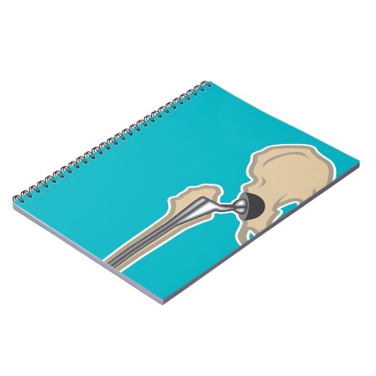 Heupgewrichtsvervanging Notitieboek (Linkerzijde)