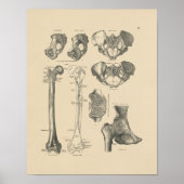  Hip Botten Anatomie 1880 Afdrukken Poster (Voorkant)