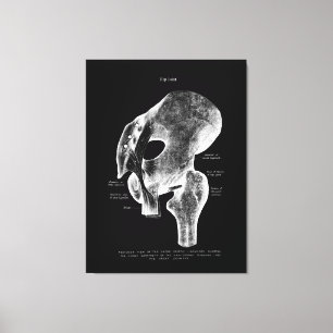 Hip Joint Anatomy Medical Large Canvas Art Afdruk