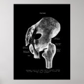 Hip Joint Anatomy Medical Poster (Voorkant)