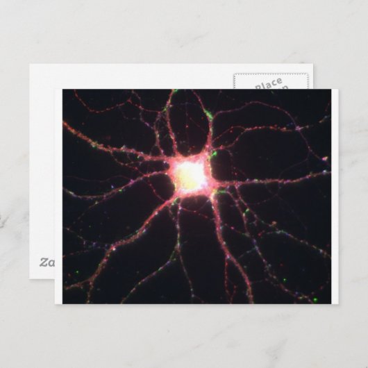Hippocampal neuronen 2 briefkaart (Voorkant / Achterkant)