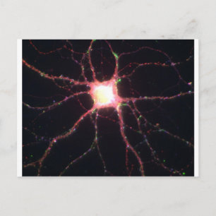 Hippocampal neuronen 2 briefkaart