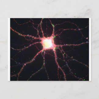 Hippocampal neuronen 2 briefkaart