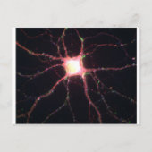 Hippocampal neuronen 2 briefkaart (Voorkant)