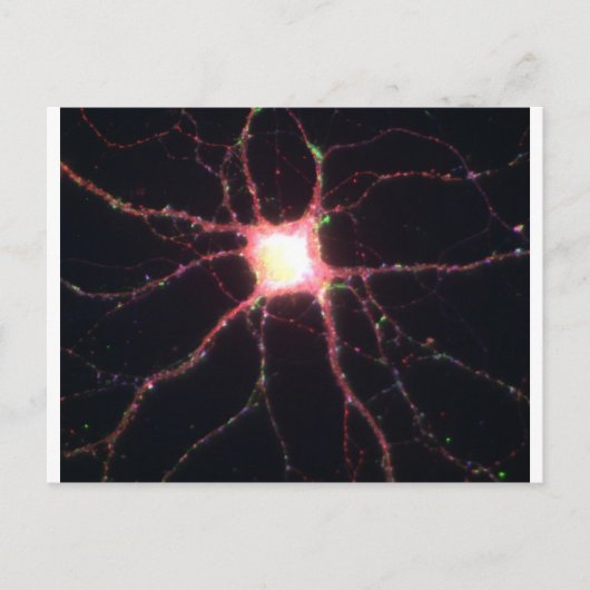 Hippocampal neuronen 2 briefkaart (Voorkant)
