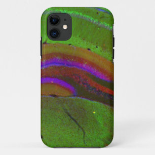 Hippocampal neuronen Case-Mate iPhone case