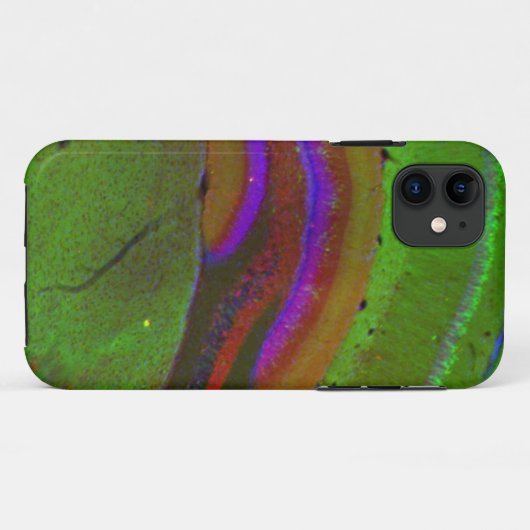 Hippocampal neuronen Case-Mate iPhone case (Achterkant (horizontaal))