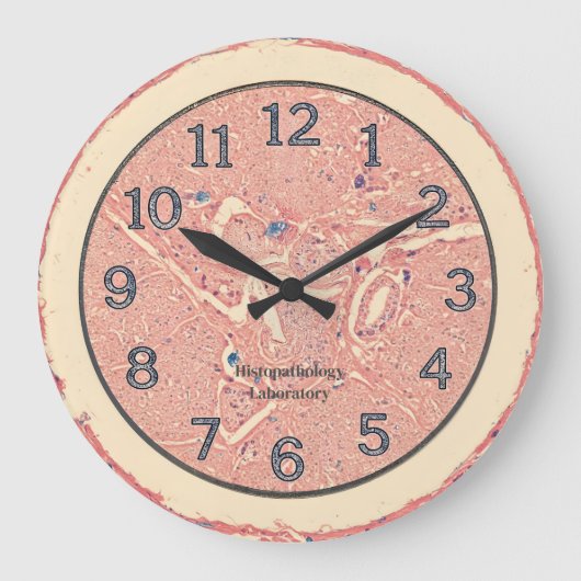 Histologie graft wandklok (Voorkant)