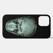 Hoofd schedel röntgenfoto Case-Mate iPhone case (Achterkant (horizontaal))