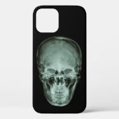Hoofd schedel röntgenfoto Case-Mate iPhone case (Achterkant)