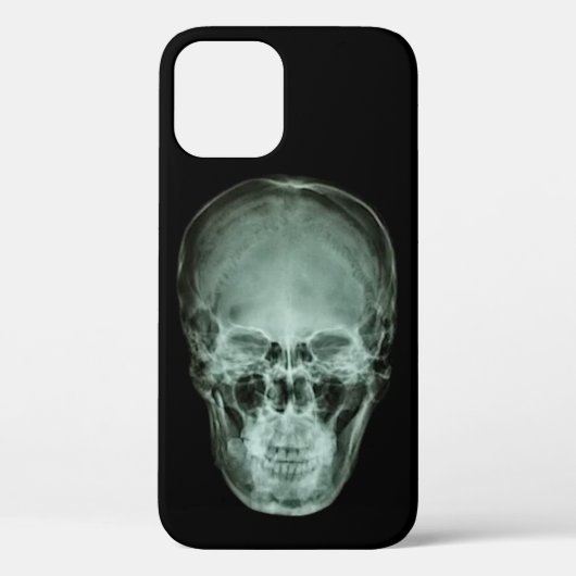 Hoofd schedel röntgenfoto Case-Mate iPhone case (Achterkant)