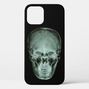 Hoofd schedel röntgenfoto Case-Mate iPhone case
