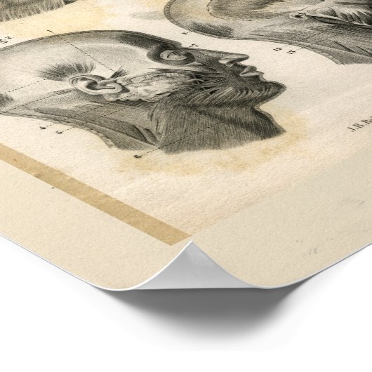 Hoofdhalsspieren  anatomie Afdrukken Poster (Hoek)