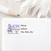 Hoop telt 3 Oesofageale kanker Etiket (Insitu)