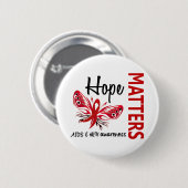 Hope Matters Butterfly AIDS Ronde Button 5,7 Cm (Voorkant /achterkant)
