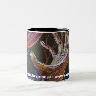 Hope - Sickle Cell Art Tweekleurige Koffiemok