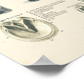 Horse Foot Hoof Leg Anatomer Farrier Chart Poster (Hoek)