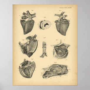 Horse Heart Anatomy 1908  Print