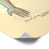 Human Arm Cutaneous Nerve Innervation Print (Hoek)