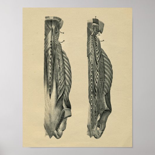 Human Back Muscle Anatomy 1902  Print (Voorkant)