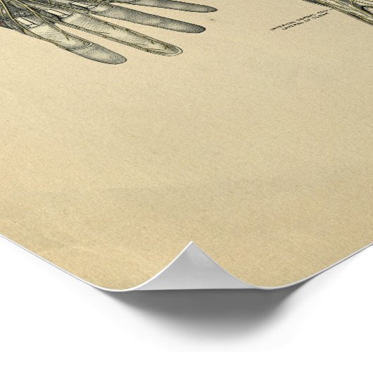 Human Hand Anatomy 1902  Print (Hoek)