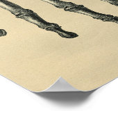 Human Hand Anatomy 1902  Print (Hoek)