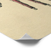 Human Hand Anatomy 1902  Print (Hoek)