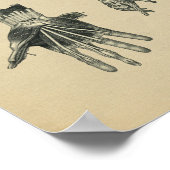 Human Hand Arm Anatomy 1902 Vintage Print (Hoek)