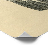 Human Hip Anatomy 1902  Print (Hoek)