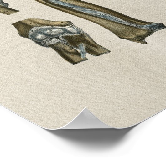 Human Joint Anatomy  Print (Hoek)