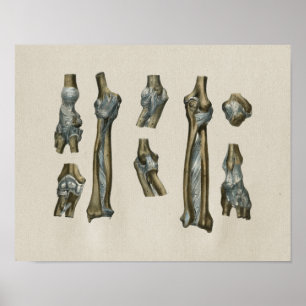 Human Joint Anatomy  Print