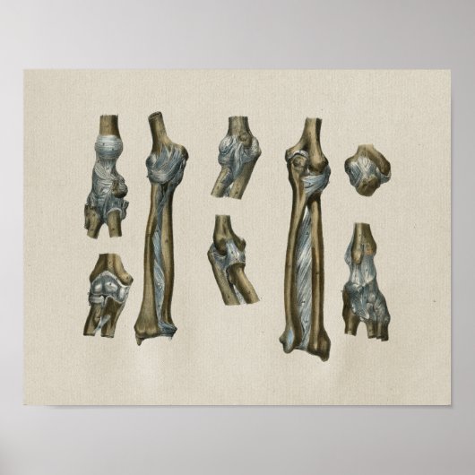 Human Joint Anatomy  Print (Voorkant)