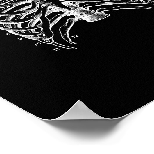 Human Ribcage Anatomy in Black and White Print (Hoek)