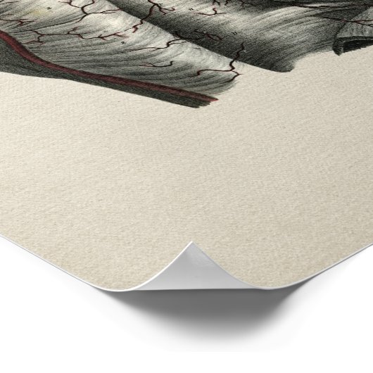 Human Shoulder Anatomy Print (Hoek)