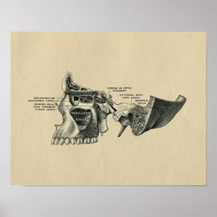 Human Skull Sinuses Anatomy 1902  Print