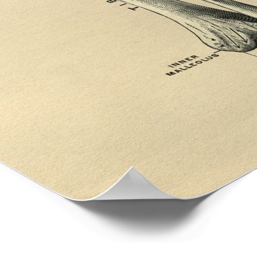 Human Tibia Anatomy 1902  Print (Hoek)