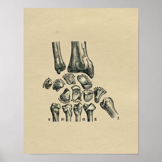 Human Wrist Anatomy 1902  Print (Voorkant)