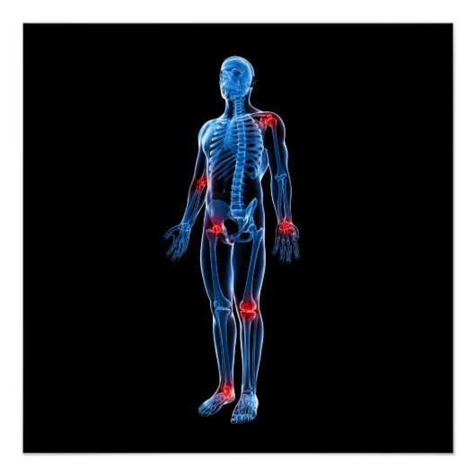 Human Xray Poster (Voorkant)