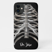  humane anatomie Skelet Skeletribben Botten Case-Mate iPhone Case (Achterkant)