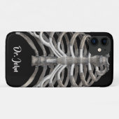  humane anatomie Skelet Skeletribben Botten Case-Mate iPhone Case (Achterkant (horizontaal))