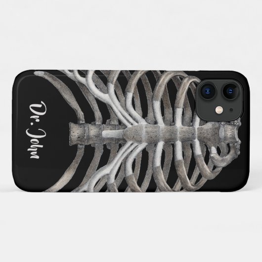  humane anatomie Skelet Skeletribben Botten Case-Mate iPhone Case (Achterkant (horizontaal))