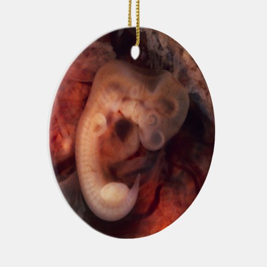 Humane embryo 7e week van de zwangerschap 5e week  keramisch ornament (Rechts)