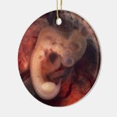 Humane embryo 7e week van de zwangerschap 5e week  keramisch ornament (Links)
