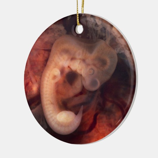 Humane embryo 7e week van de zwangerschap 5e week  keramisch ornament (Links)