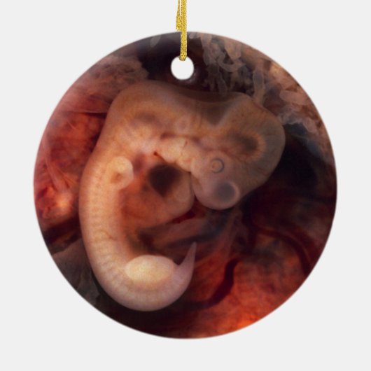 Humane embryo 7e week van de zwangerschap 5e week  keramisch ornament (Achterkant)